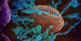 Texas Biomed establishes team to study SARS-CoV-2, new coronavirus